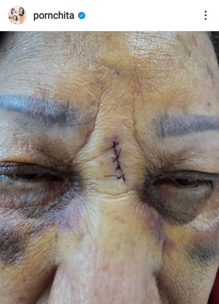 “เบนซ์ พรชิตา” ร่ายยาว หลังคุณแม่ประสบอุบัติเหตุกลางห้างดัง