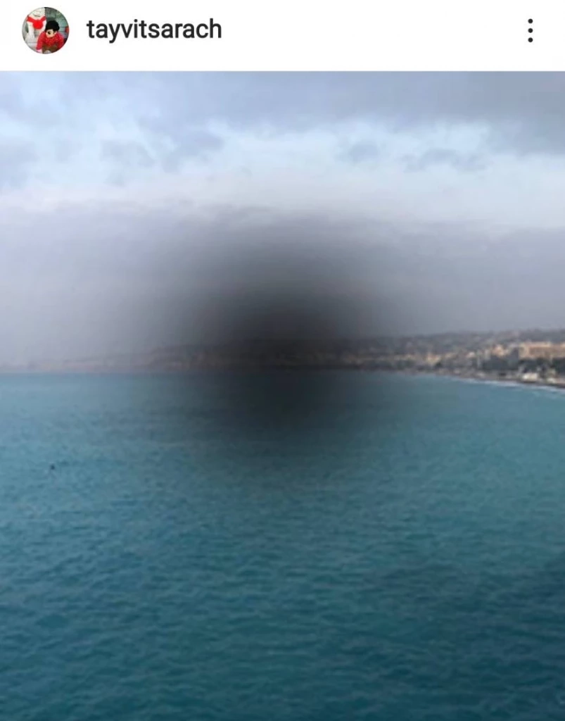 "เต้ วิทย์สรัช" ป่วยรับต้นปี จอประสาทตาบวมน้ำ