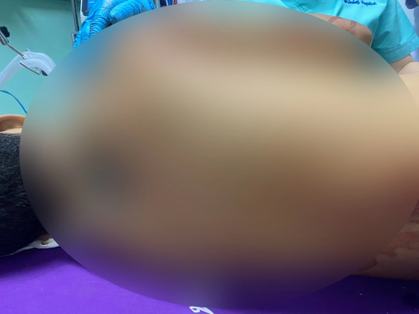 วัยรุ่น! เขม่นกันในตลาด ชักมีดไล่แทงกันดับ 1 ราย