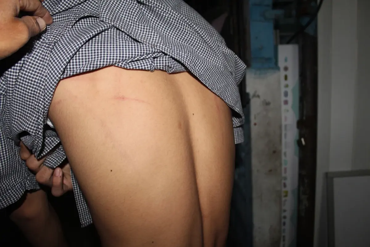 ร่องรอยถูกตีและถูก