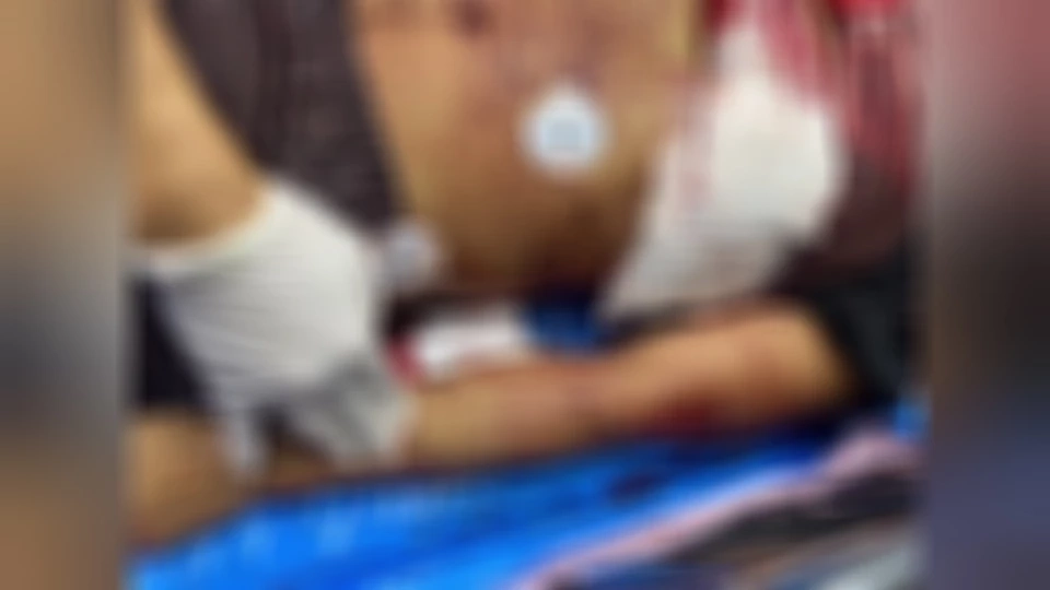 สภาพบาดแผล มีรอยแทงทั่วตัว