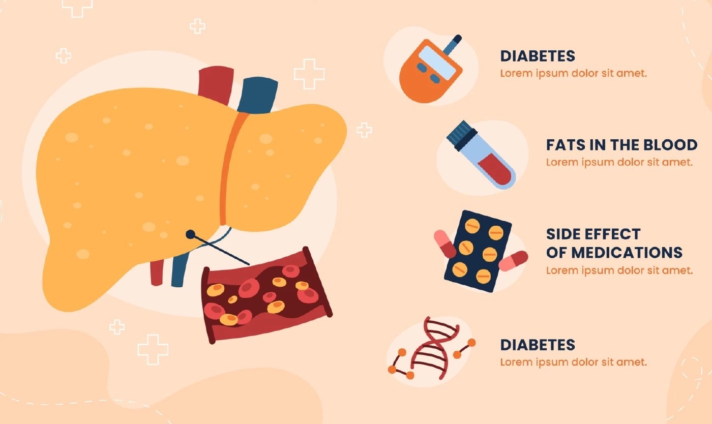 ‘ไขมันพอกตับ’ กลุ่มโรคกินดีอยู่ดีที่สร้างปัญหา