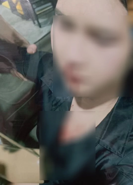 ผู้เสียหายได้รับบาดเจ็บ เลือดออกที่ใบหน้า