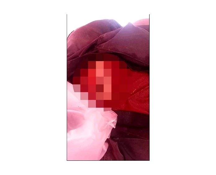 รอยบาดแผลที่ถูกกระทิงขวิด