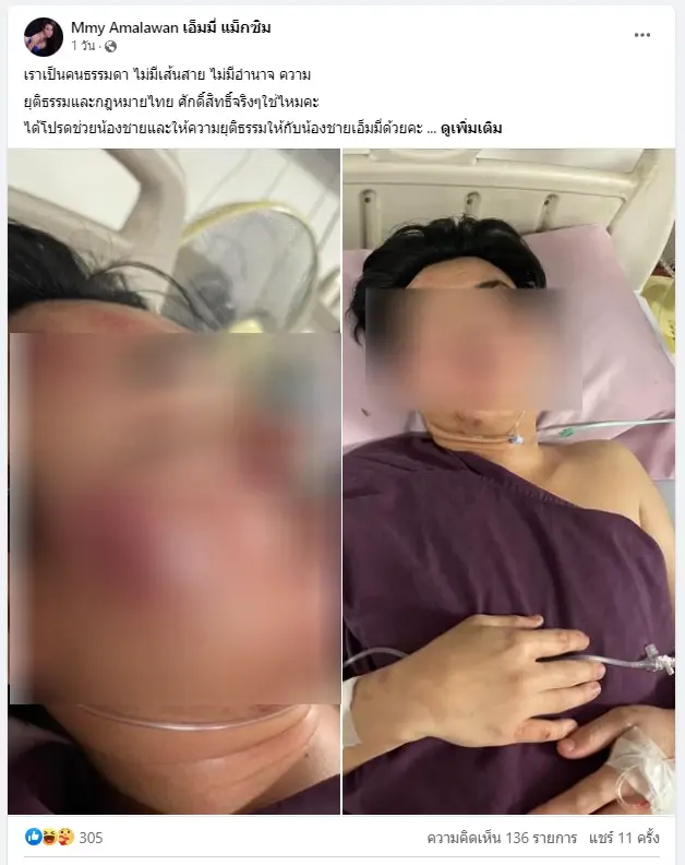 เปิดภาพกล้องวงจรปิด น้อง"เอ็มมี่ แม็กซิม"โดนรุมทำร้าย