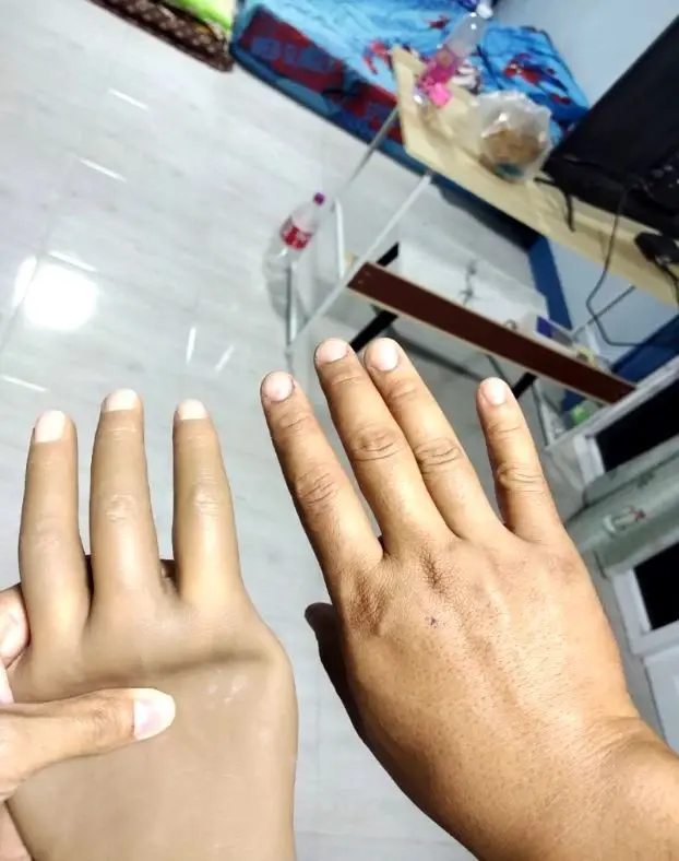 สาวสุดช้ำ! สั่งซื้อนิ้วเทียมให้สามี ได้สินค้าไม่ตรงปก ขอเงินคืนกลับโดนด่า