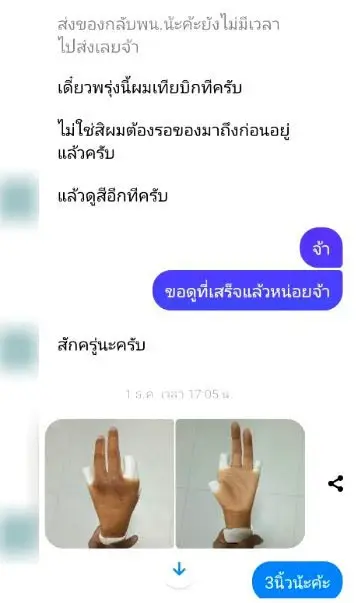 สาวสุดช้ำ! สั่งซื้อนิ้วเทียมให้สามี ได้สินค้าไม่ตรงปก ขอเงินคืนกลับโดนด่า