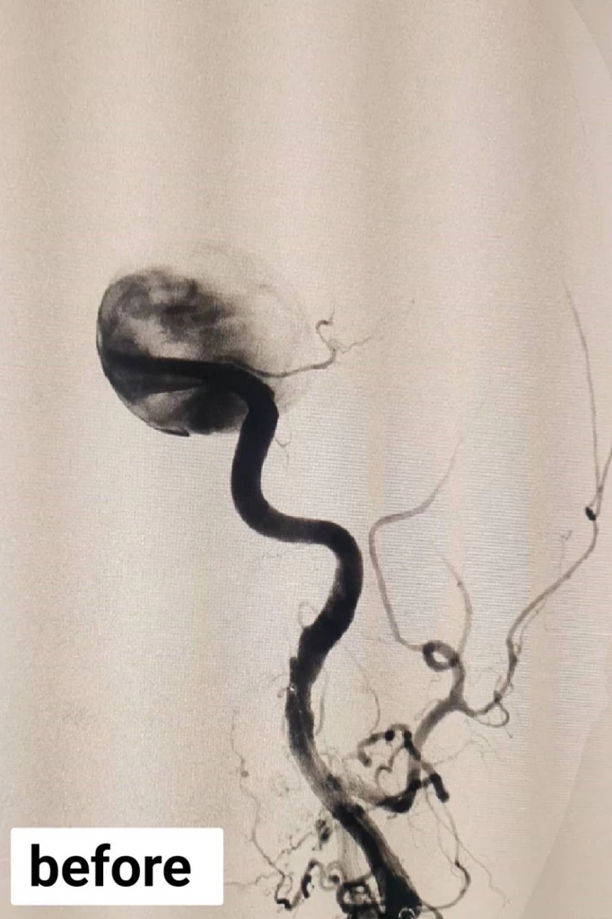 เคสใหญ่ ผู้ป่วยปวดหัว ตามัวมานาน ตัดสินใจพบแพทย์ ผลตรวจ MRI เผยความจริง