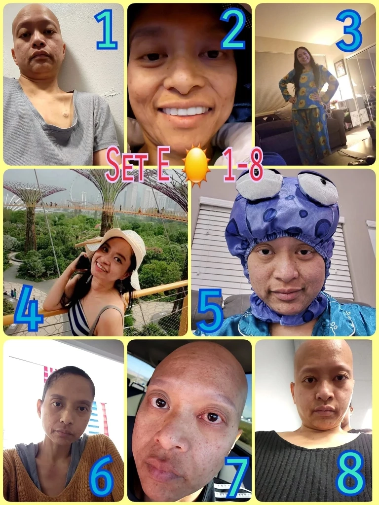 สุดเศร้า "กิ๊ฟท์" สาวสู้มะเร็งระยะสุดท้าย แจ้งข่าว 3 วันจะไปอยู่ดาวดวงอื่นแล้ว