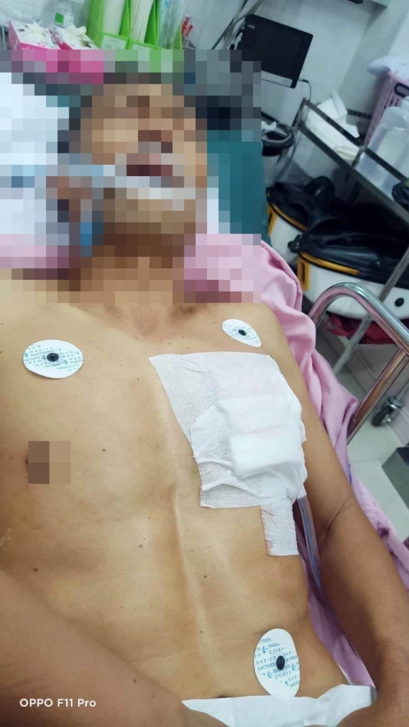 นายเสริม หรือ คึกฤทธิ์ เต็มฟอม อายุ 53 ปี อดีต นายก อบต.บึงนคร