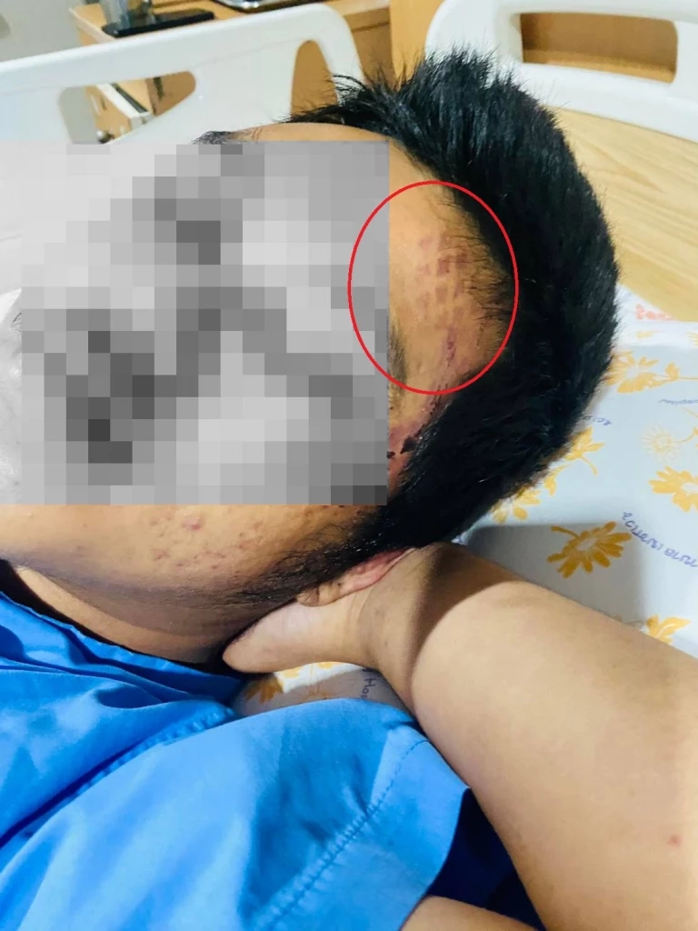 พี่สาวร้องเพจสายไหมฯ น้องชายถูกรุมจนสลบ ปลุกมาทำร้ายซ้ำ คดีไม่คืบหน้า