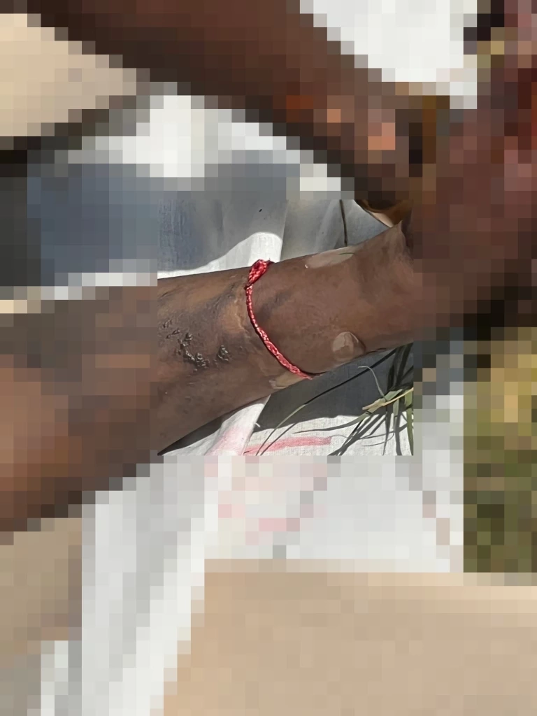 ตร.เร่งคลี่คดีฆ่า 3 ศพหมกป่า อึ้งพบเชือกแดงผูกข้อมือ โยงค้าแรงงานข้ามชาติ