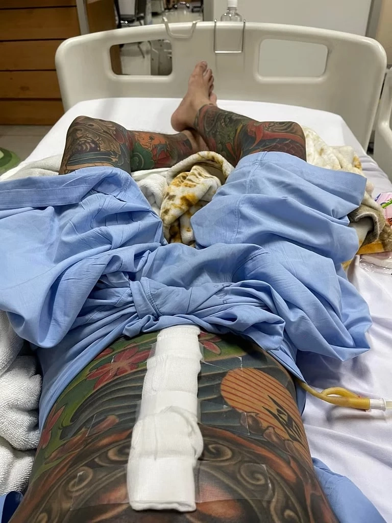 โซเชียลแห่แชร์ หนุ่มเฉียดดับ ปวดท้องหนัก 5 วัน เจอไส้เน่า รีบผ่าตัดช่วยชีวิต