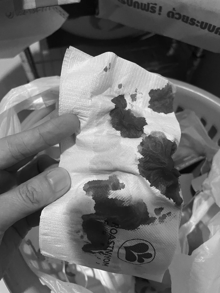 คุณแม่เชียงใหม่ แชร์"PM2.5"สุดอันตราย ลูกสาว 9 ขวบกำเดาไหลรุนแรง