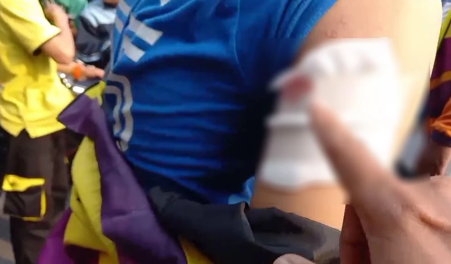 พลทหารหึงโหด ปาระเบิดปิงปองใส่กลุ่มไรเดอร์ ที่จอดรองาน หน้าร้านแฟนสาว