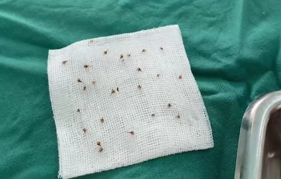 อุทาหรณ์งานบวช ผึ้งตกใจเสียงรถแห่ ต่อยชาวบ้าน เจ็บระนาว