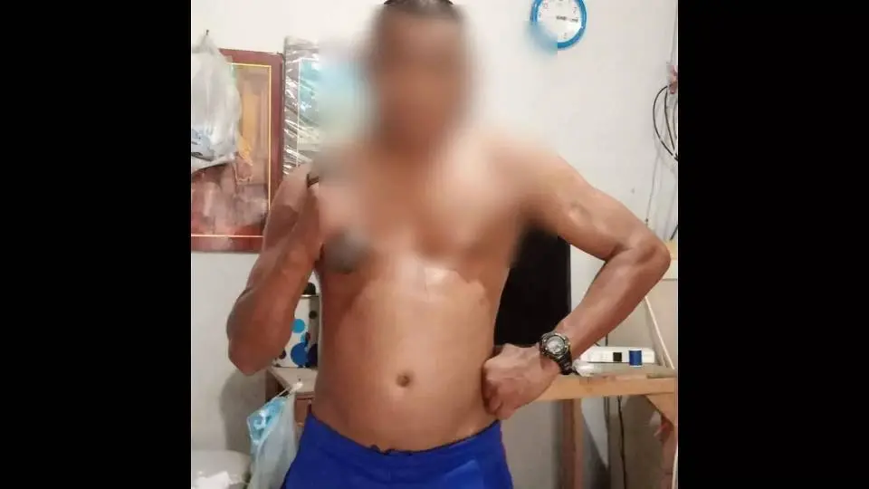 พ่อเลี้ยงโหด ใช้ท่อนไม้กระหน่ำตีลูกเลี้ยงวัย 15 ปี เลือดคั่งสมอง