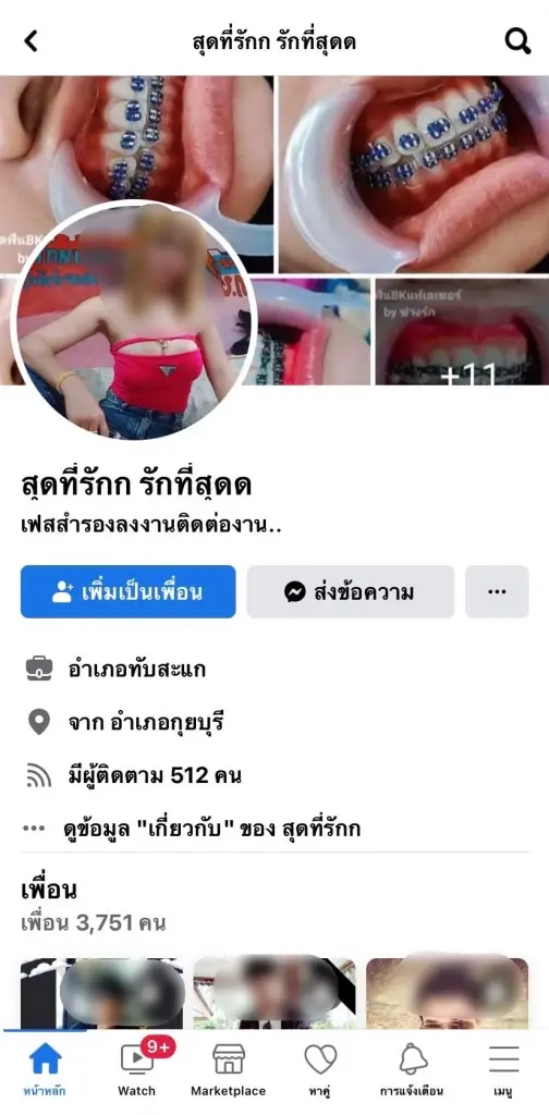 ปคบ. จับสาวไลฟ์สด"จัดฟันเถื่อน" เตือนสุดอันตราย ติดเชื้อในปากถึงฟันร่วง
