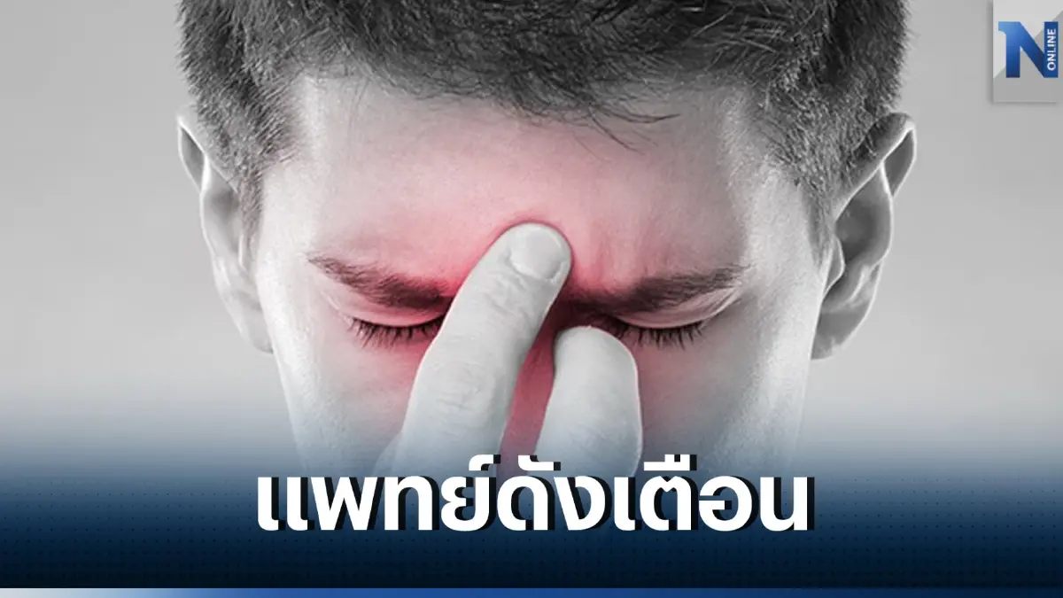 แพทย์ดังโพสต์เตือน ยา “เออร์กอท” ใช้ไม่ถูก เส้นเลือด หัวใจ สมอง แขน ขาตัน