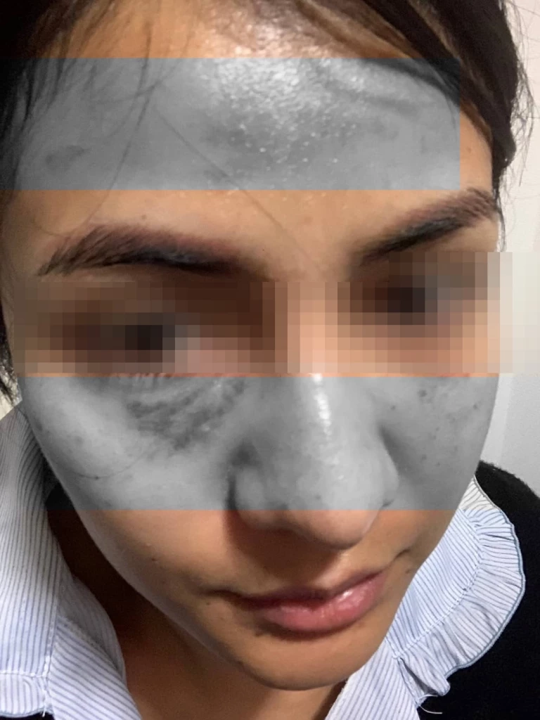 ร่องรอยจากการถูกทำร้าย