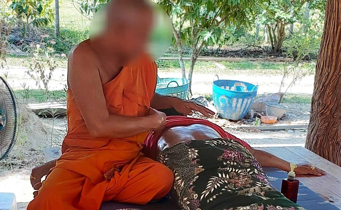 เตือนอย่าหลงเชื่อ พระรักษาพิเรนทร์ ให้นอนย่างไฟ จนเป็นแผลพุพอง