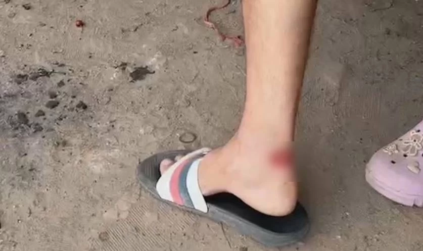 ระทึก! วันไหลเดือด วัยรุ่นปาระเบิดปิงปอง เจ็บ 2 ราย