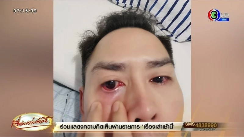 'หมอมนูญ' เผยข้อมูล ชายไทยวัย42 ติดโควิด-19 คาดสายพันธุ์ XBB.1.16