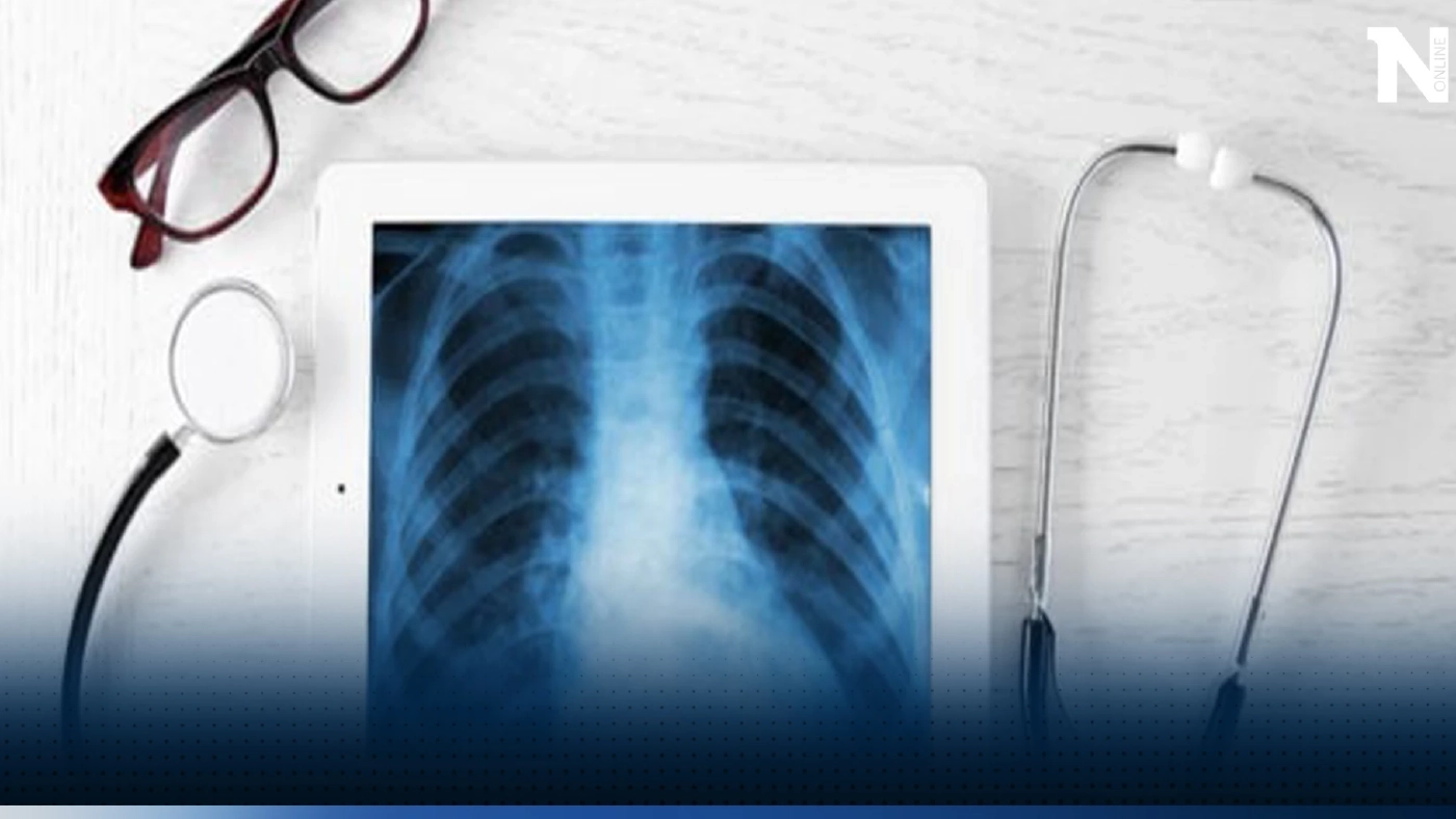 ข่าวดีคนรักปอด เปิดพิกัด 8 จุดวอล์คิน ตรวจปอดฟรี วันที่ 3- 21 เม.ย. ย้ำว่าฟรี