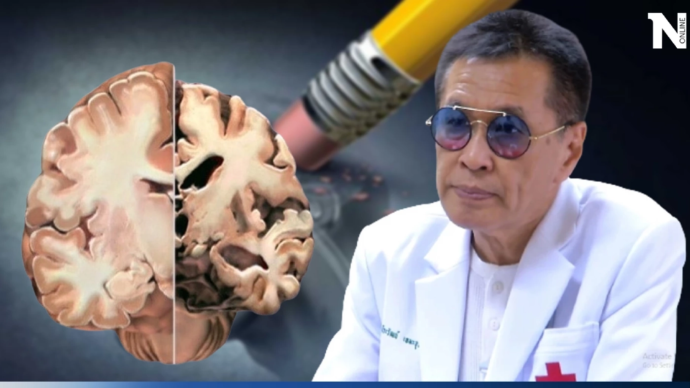 หมอดื้อเตือน "สมองเสื่อมวัยชราพุ่งสูง ตรวจรู้ล่วงหน้าช่วยได้ เอาชนะได้"