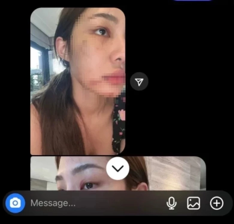 ยิ่งรู้ยิ่งเศร้า เรื่องราว'จีจี้ สุพิชชา' แพทย์ชี้ชัดผลชันสูตรเหตุสิ้นใจ