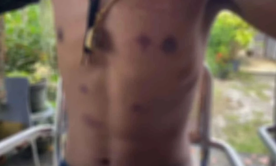 ทนายอาร์ม รอพาผู้เสียหายแจ้งความ-ร้องเรียน ทบ. เอาผิด "หมอนายพล"