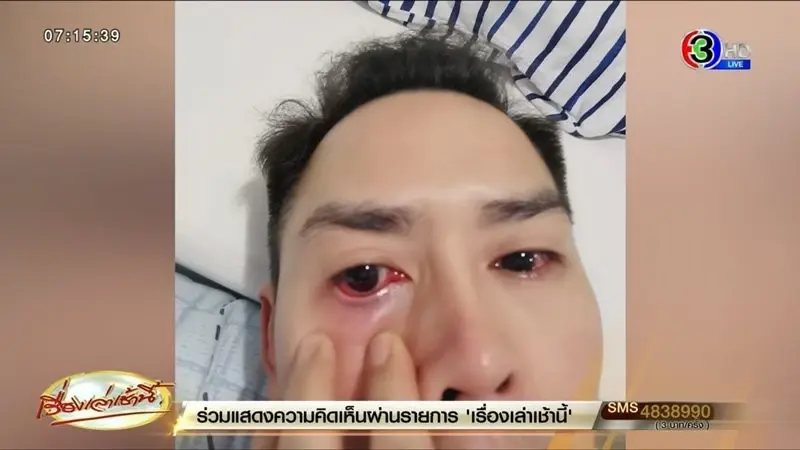 "หมอธีระ" อัปเดตสถานการณ์โควิด เผย XBB.1.16 ครองโลก