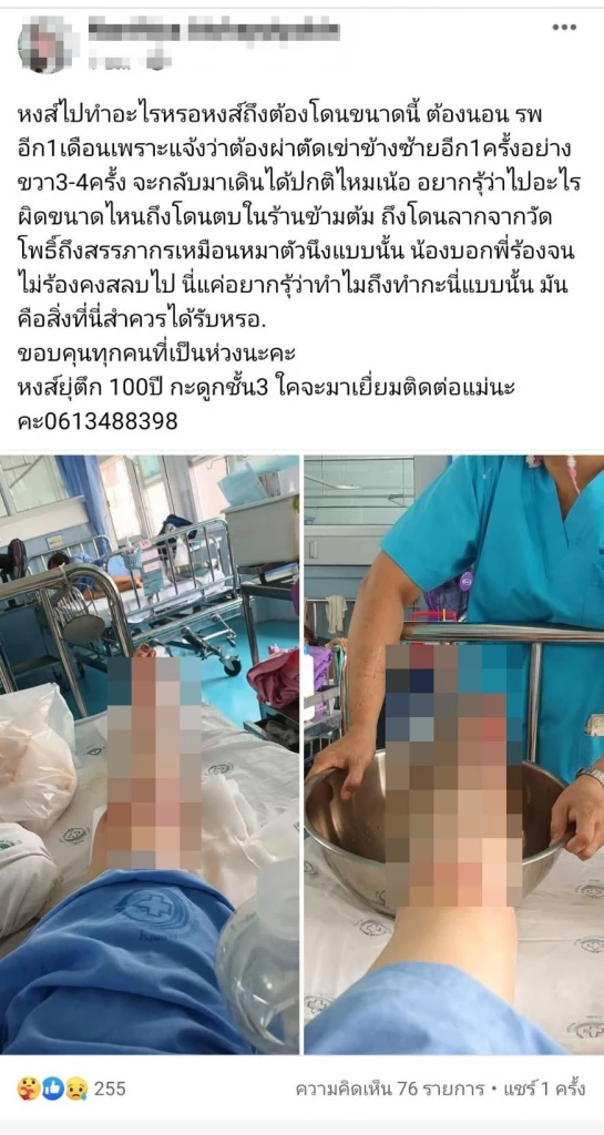 โหดจัด! หนุ่มหึงโหด บุกตบแฟนสาวพีอาร์ ก่อนจับขึ้น จยย.ลากไปกับถนนเจ็บสาหัส