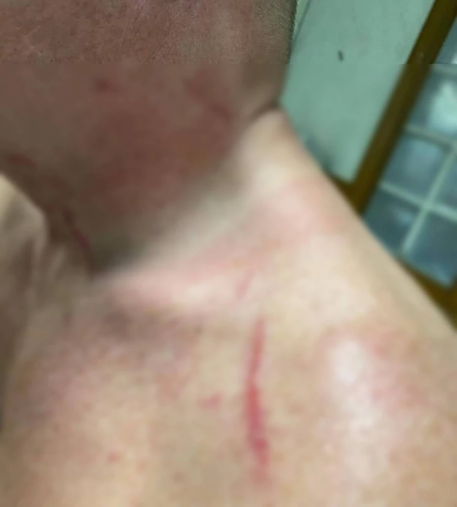 สุดโหด โจ๋ไทใหญ่รุมทำร้าย นทท. ซ้ำชิงทรัพย์ก่อนหลบหนี