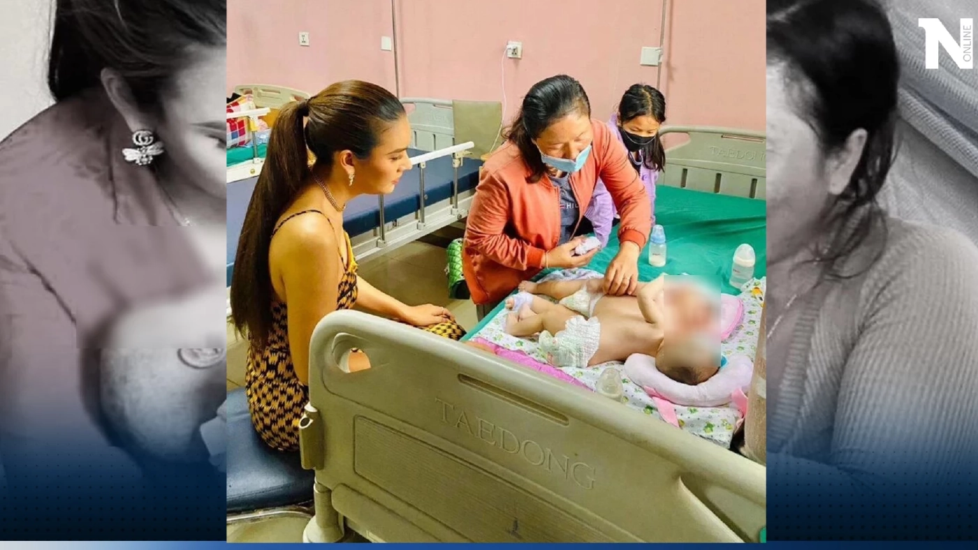 "เมญ่า รวิสรา" โพสต์ข่าวเศร้า น้องแฝดตัวติดกัน สปป.ลาว เสียชีวิตแล้ว