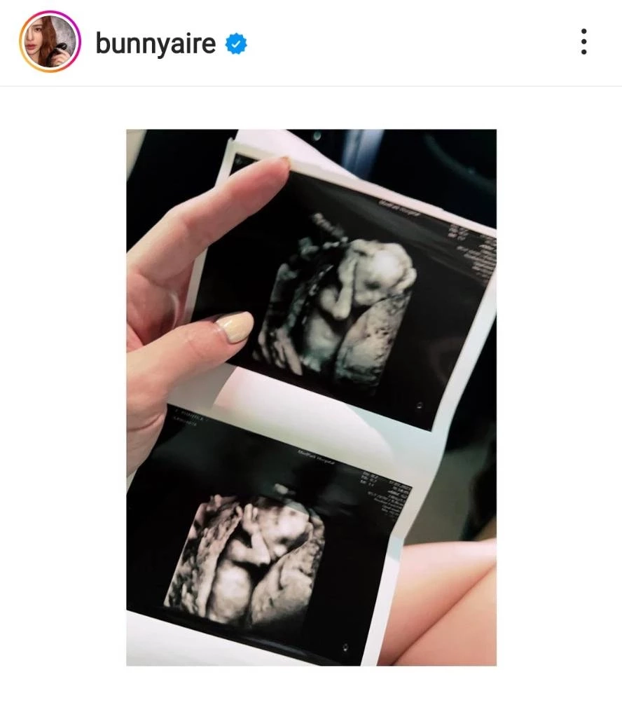 แอร์ ภัณฑิลา ประกาศข่าวดีมีลูกสมใจ ฮอร์โมนสวิงร้องไห้ไม่หยุด