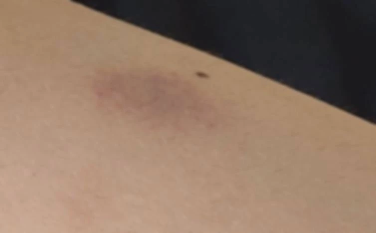 แม่ร้อง ลูกสาววัย 12 ถูกรุ่นพี่รุมกระทืบ แถมถ่ายคลิปขู่