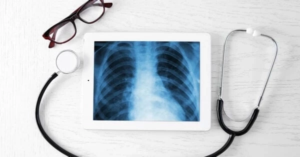 ข่าวดีคนรักปอด เปิดพิกัด 8 จุดวอล์คิน ตรวจปอดฟรี วันที่ 3- 21 เม.ย. ย้ำว่าฟรี