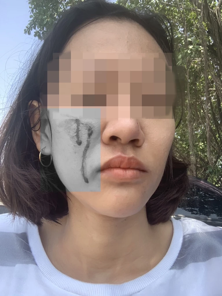 ลูกหนี้โหด ซ้อมสาวเจ้าหนี้ กรรไกรกรีดหน้า ราดน้ำมันจะเผาทั้งเป็น