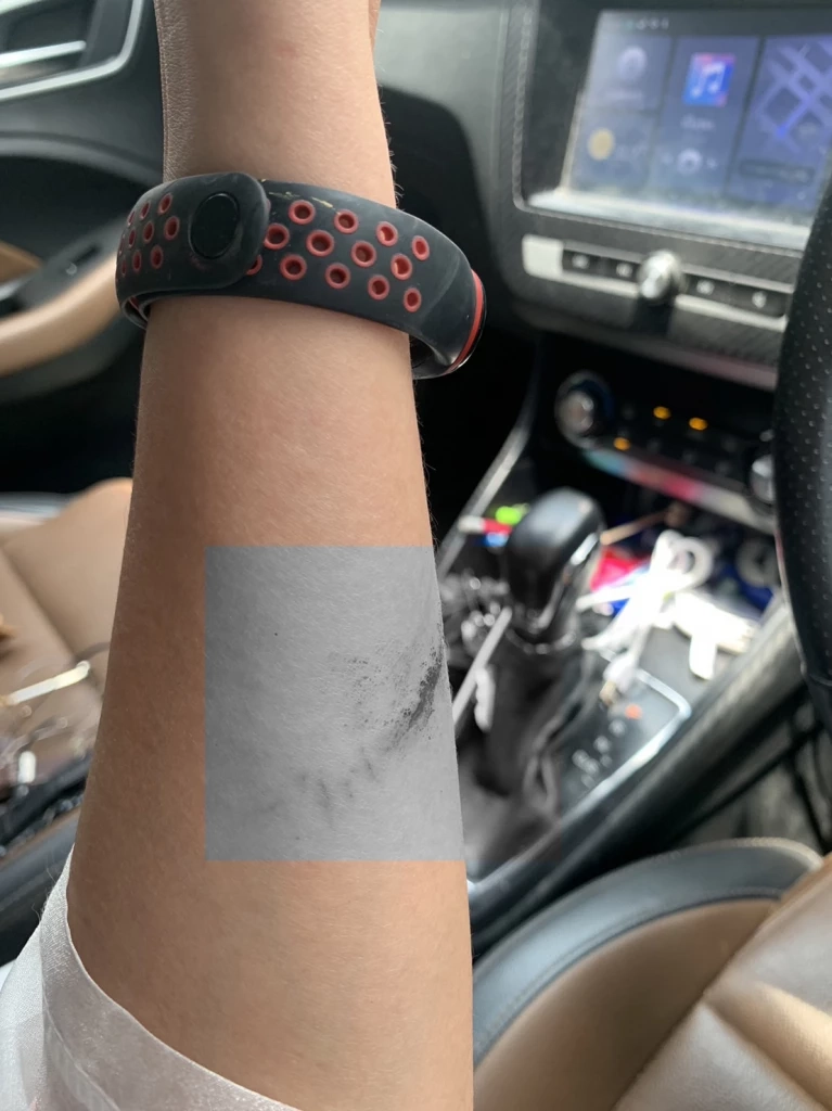 ลูกหนี้โหด ซ้อมสาวเจ้าหนี้ กรรไกรกรีดหน้า ราดน้ำมันจะเผาทั้งเป็น