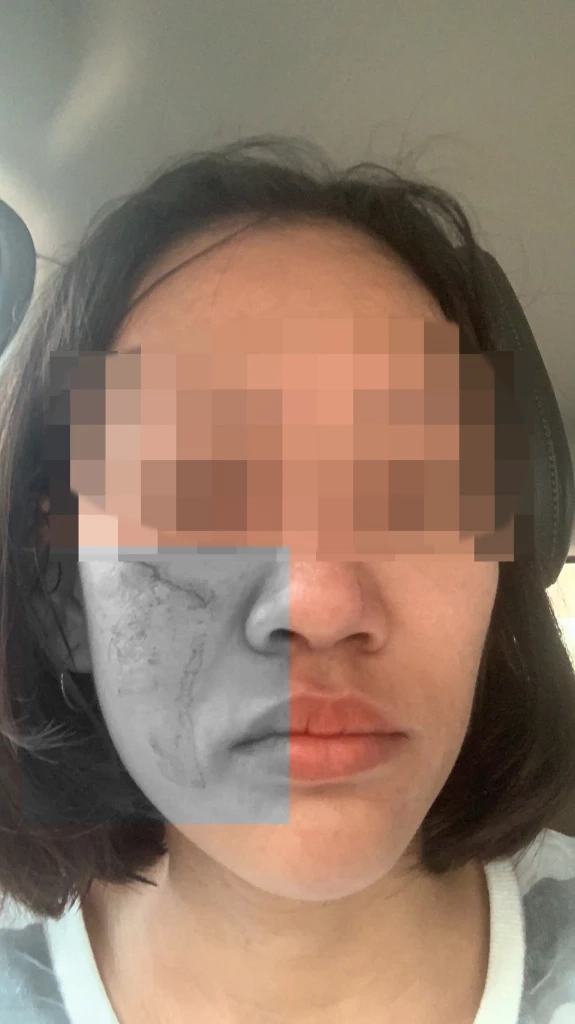 ลูกหนี้โหด ซ้อมสาวเจ้าหนี้ กรรไกรกรีดหน้า ราดน้ำมันจะเผาทั้งเป็น