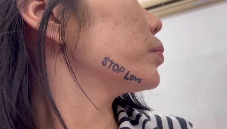 น.ส.สุณัญญา ผู้เสียหายถูกบังคับสักใบหน้า