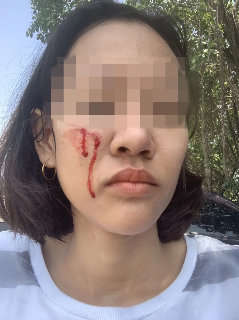 ตำรวจออกหมายเรียก "ลูกหนี้โหด"ทำร้ายสาวเจ้าหนี้ ขู่จะเผาทั้งเป็น