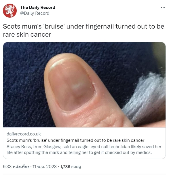 สุดช็อก สาวไปทำเล็บที่ร้าน แต่โดนช่างปฏิเสธ แถมแนะให้รีบไปพบแพย์ด่วน