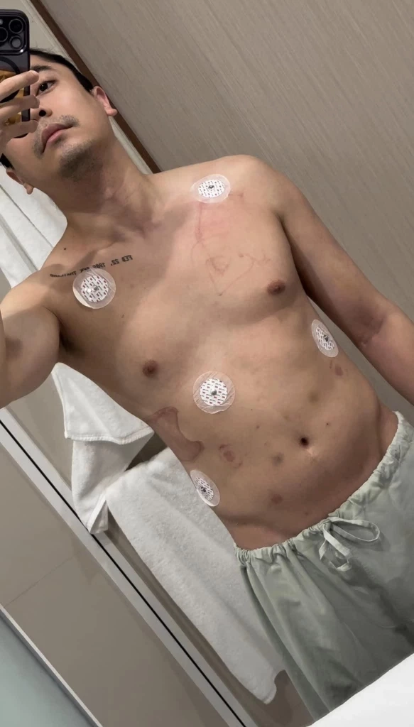 สุดช็อก กี กีรติ พิธีกรชื่อดัง หัวใจหยุดเต้น 19 นาที เหมือนตายแล้วเกิดใหม่