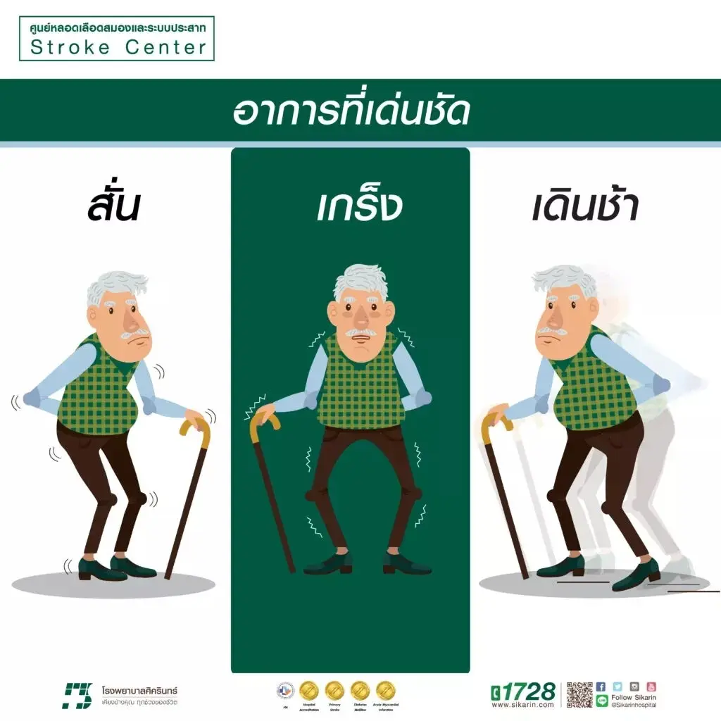 หมอดื้อ เปิดประเด็นร้อนๆ "พาร์กินสัน ถ้ามีความดันร่วง เสี่ยงสมองเสื่อม"