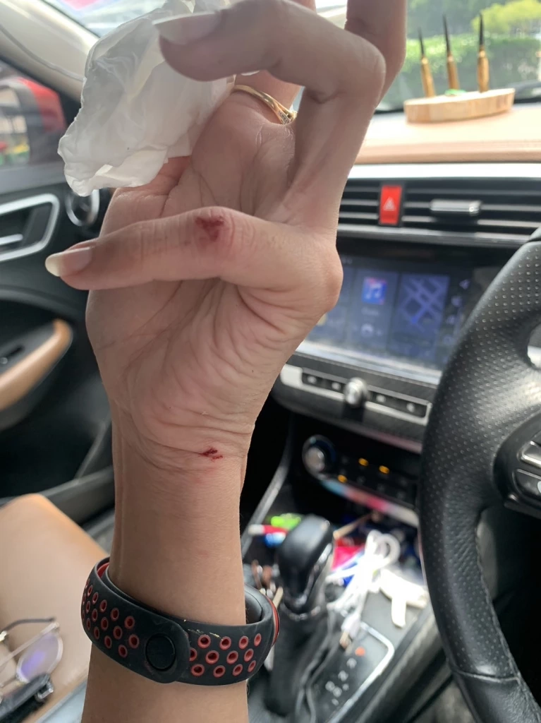 ตำรวจออกหมายเรียก "ลูกหนี้โหด"ทำร้ายสาวเจ้าหนี้ ขู่จะเผาทั้งเป็น