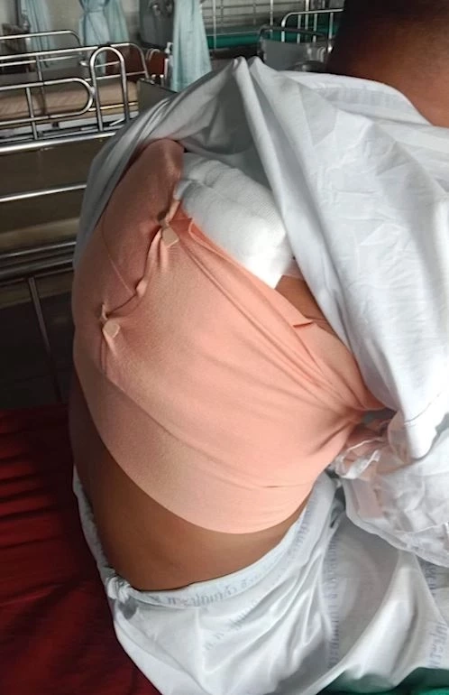 อส.ทหารพราน ขอความเป็นธรรม ถูกรุ่นพี่ใช้ M16 ยิงหลัง กลับโดนสั่งปลดทั้งคู่