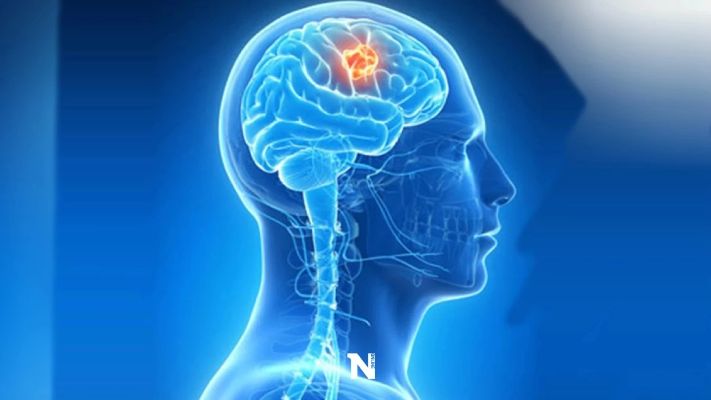 หมอดื้อ โพสต์ให้ความรู้ ความเข้าใจ ภาวะสมองถูกหลอก คืออะไร ?