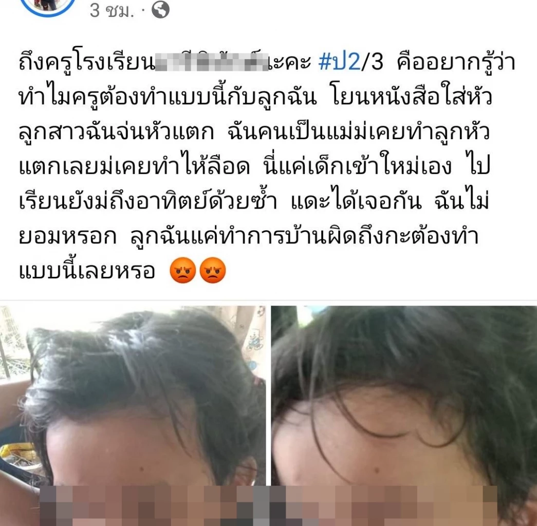 บีบหัวใจ! แม่ร้องลูก ป.2 โดนครูโยนหนังสือใส่หัวเลือดซึม แค่ทำการบ้านผิด